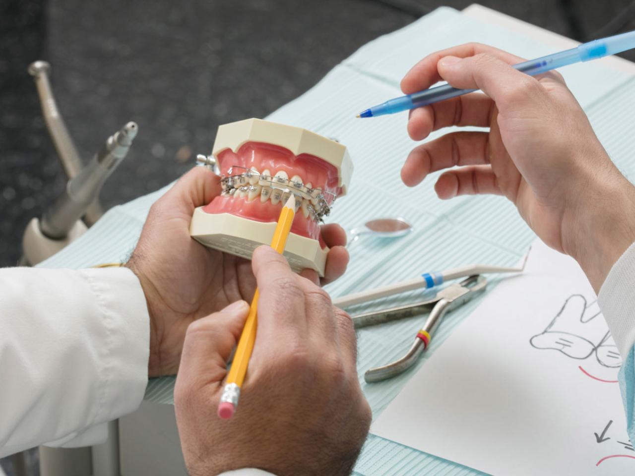 two dentists examining a fake set of teeth with braces
