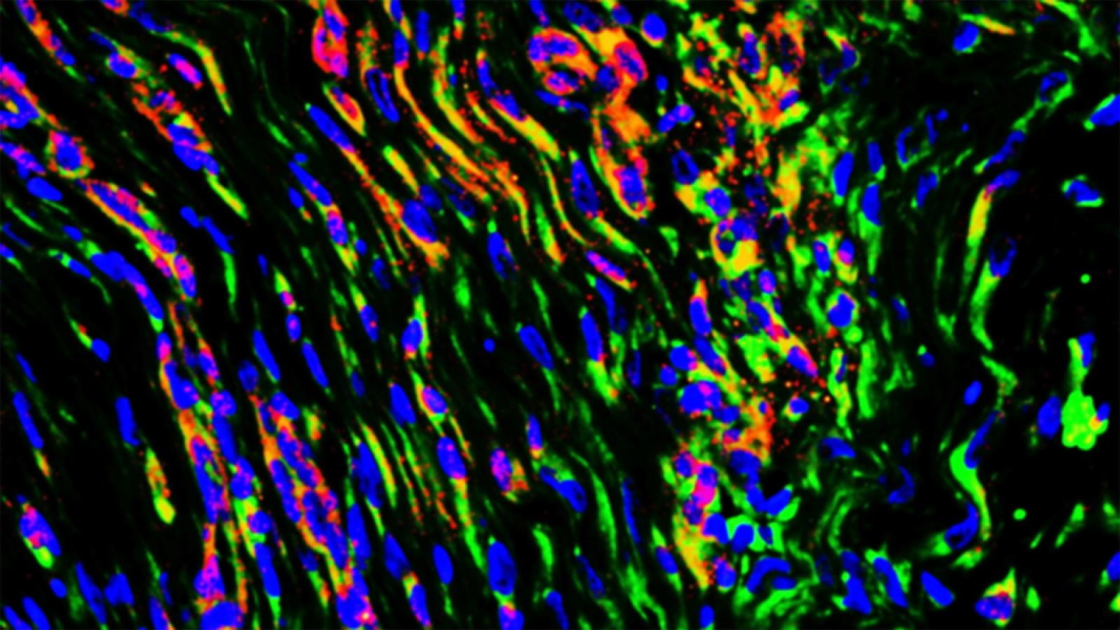 Microscopic image of tendon